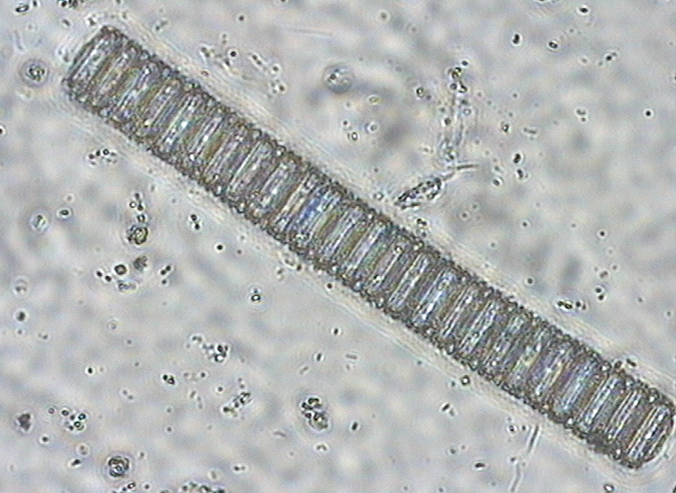 Dictyocha speculum